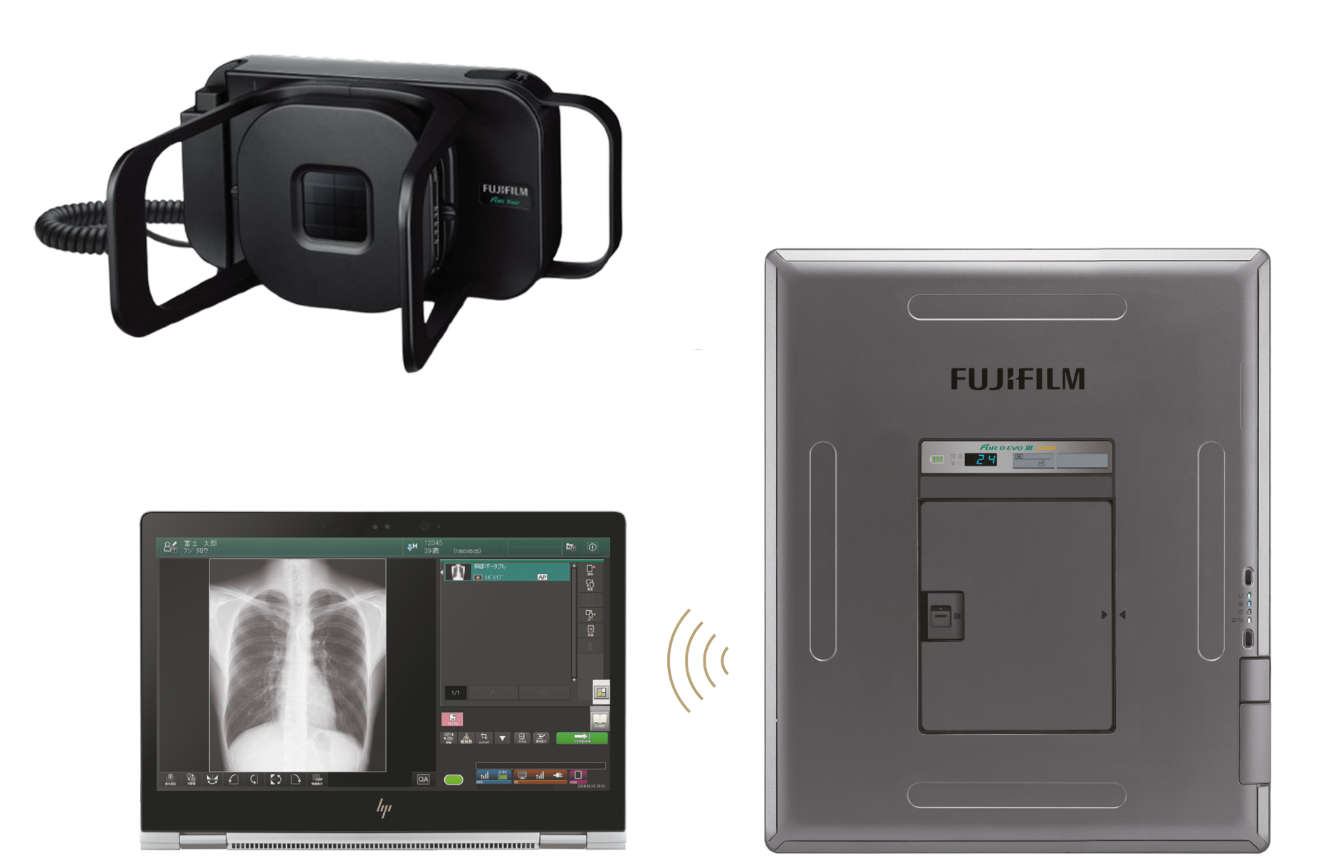 Équipement de radiologie mobile